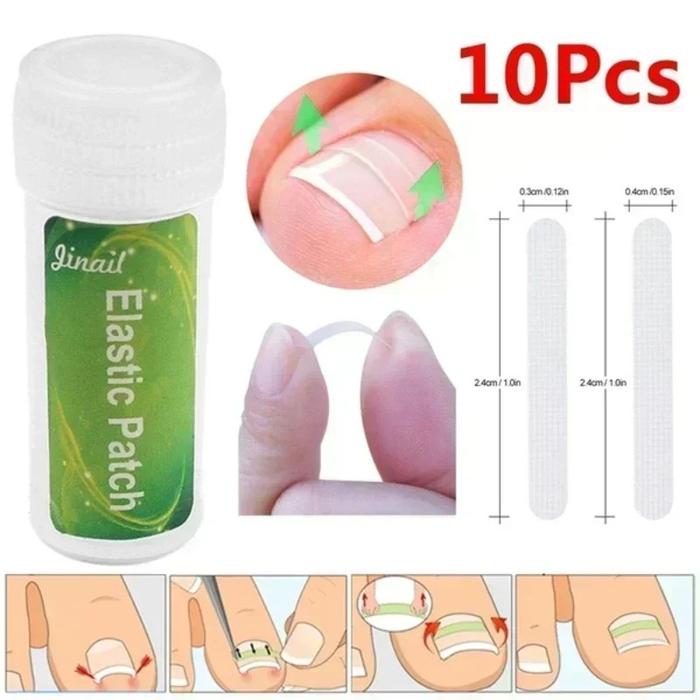 10pcs Ingrown Toenail Correction Clips