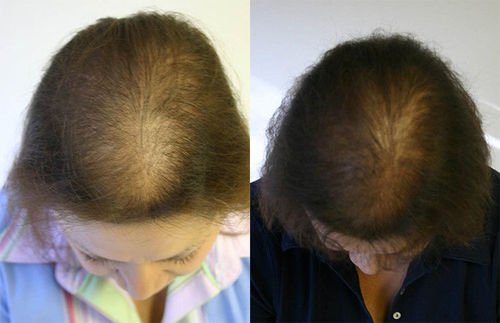7 Days Hair Regrowth Serum, Hair Nutrient Solution photo review