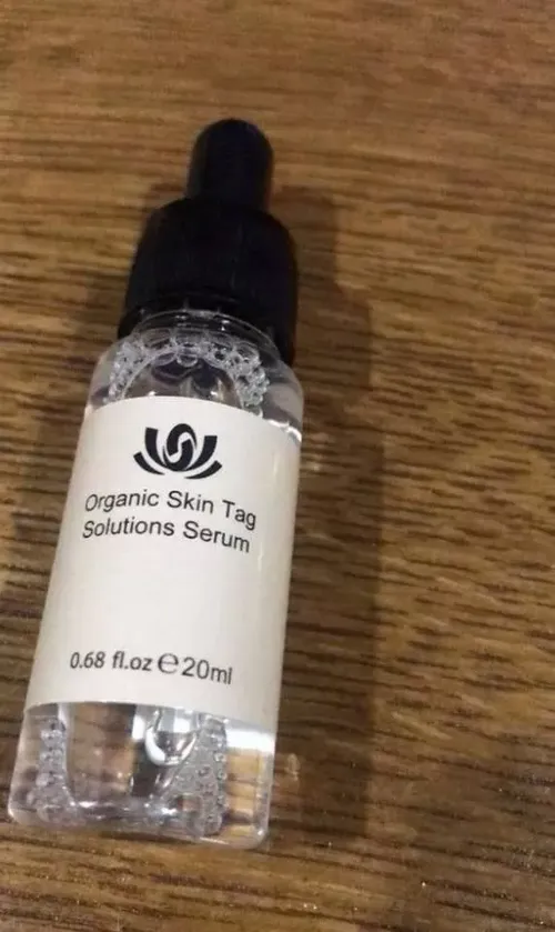 All-Natural Skin Tag and Mole Removal Serum, Herbal Formula photo review