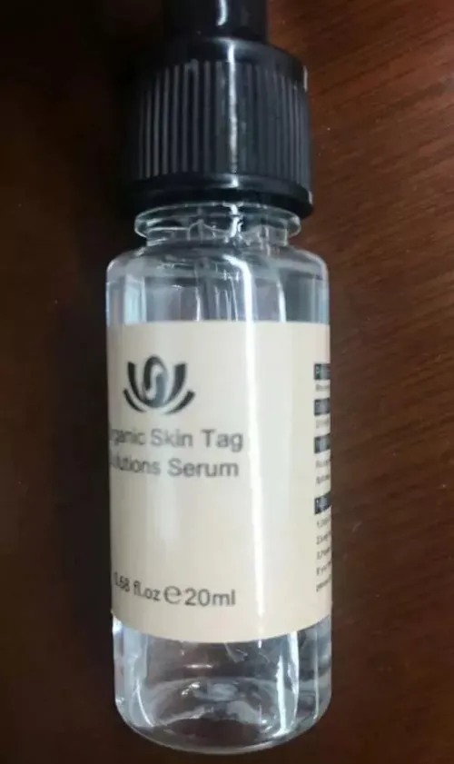 All-Natural Skin Tag and Mole Removal Serum, Herbal Formula photo review