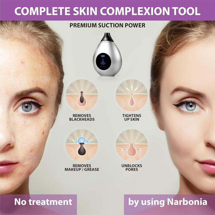Electric Blackhead Remover Vacuum with 4 Suction Heads