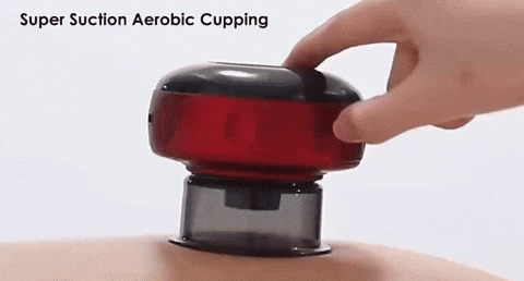 Electric Vacuum Cupping Device with Heating, Massage &amp; Scraping
