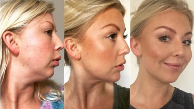 Facial Slimming Massager Women V Shape Facial Lifting Device photo review