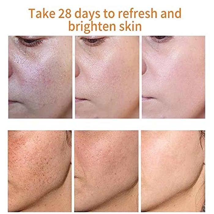 Freckle Cream Moisturizing Anti-Aging Remove Dark Spots