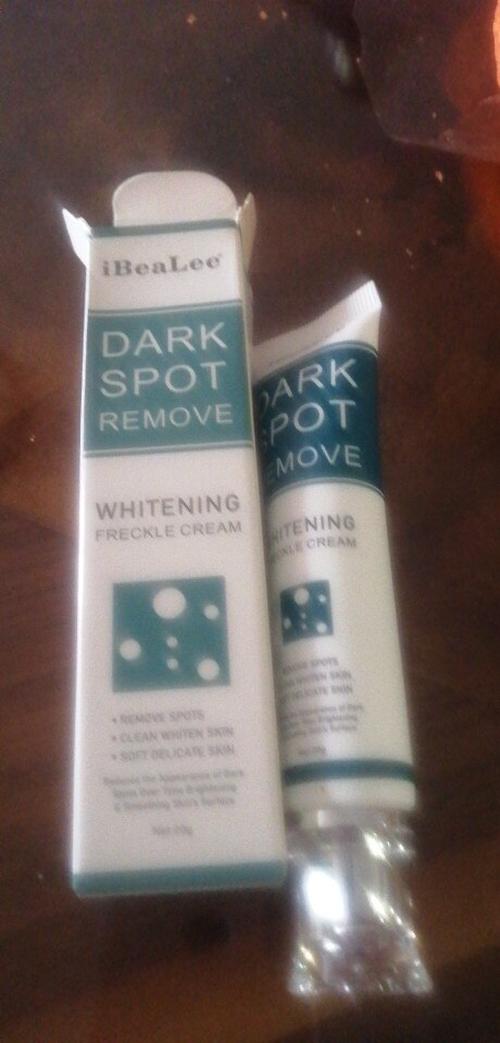 Freckle Cream Moisturizing Anti-Aging Remove Dark Spots photo review