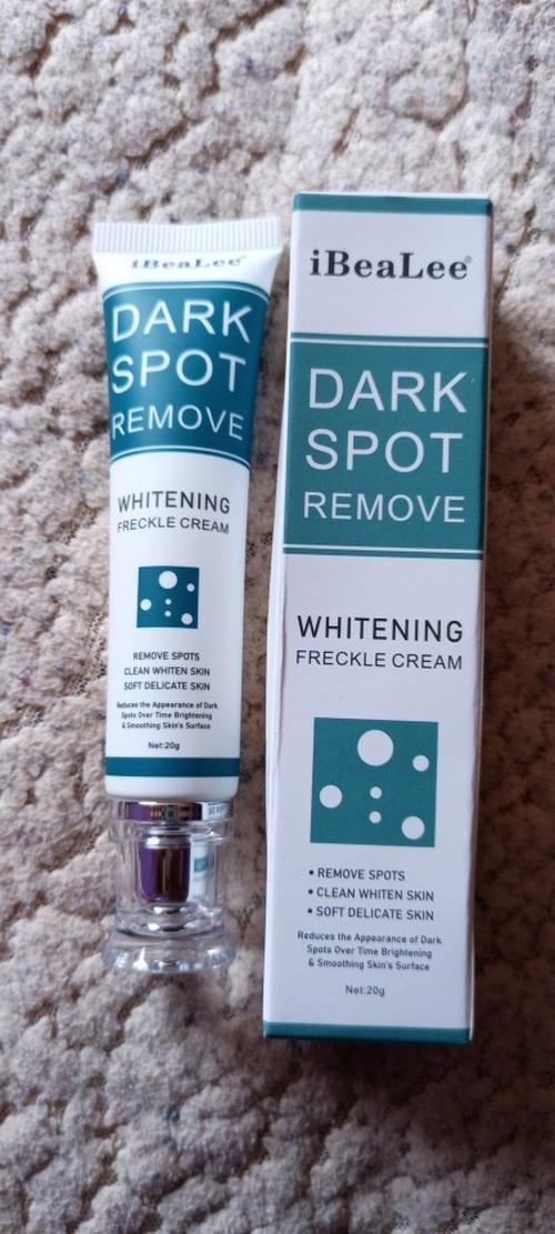 Freckle Cream Moisturizing Anti-Aging Remove Dark Spots photo review