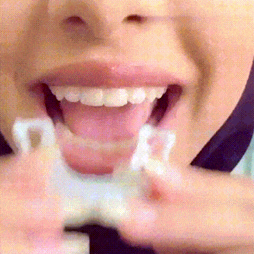 Magic Teeth Snap On Veneers