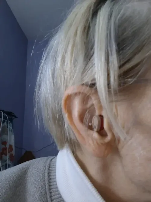 Rechargeable Invisible Hearing Aids with Charging Case and Accessories photo review