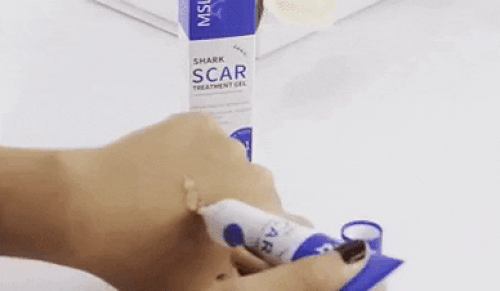 Scar Removal Cream Remove Acne Spots Treatment Stretch Marks Surgical Burns