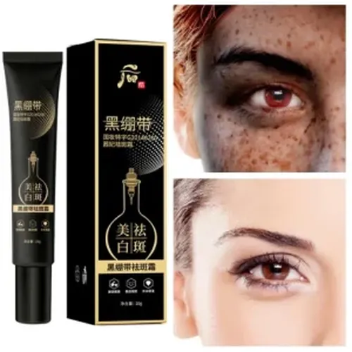 Skin Whitening Freckle Removal Cream