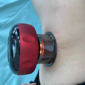 Electric Suction Cup Body Massage Cup Anti Cell Therapy Body photo review