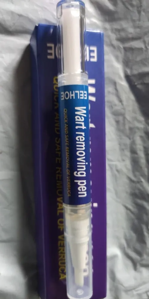 Wart Removal Pen photo review