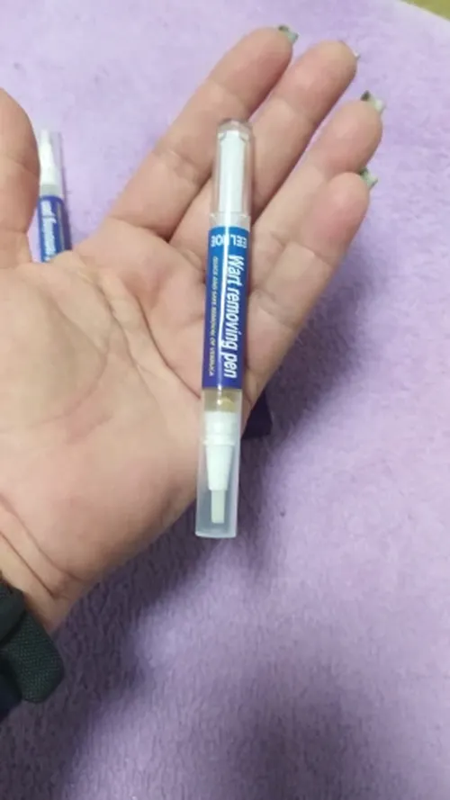 Wart Removal Pen photo review