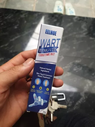 Warts Remover Ointment photo review